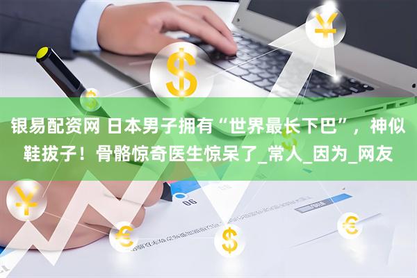 银易配资网 日本男子拥有“世界最长下巴”，神似鞋拔子！骨骼惊奇医生惊呆了_常人_因为_网友